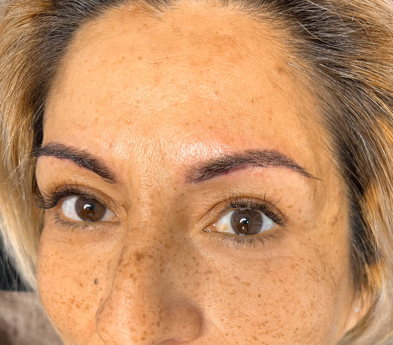 MICROPIGMENTACION CAJAS MALLORCA DERMAELITE 1