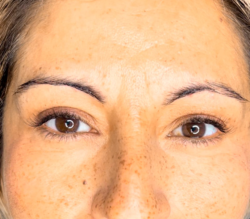 MICROPIGMENTACION CAJAS MALLORCA DERMAELITE