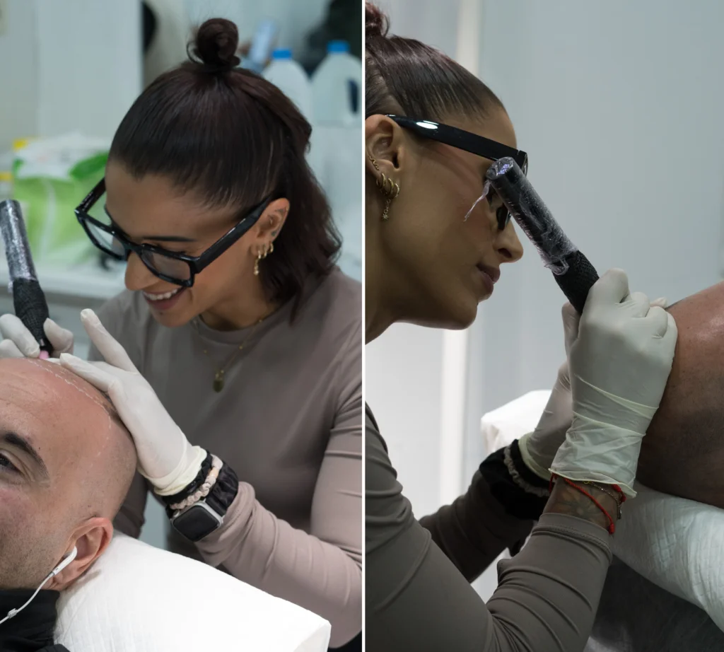 especialistas en micropigmentacion capilar mallorca